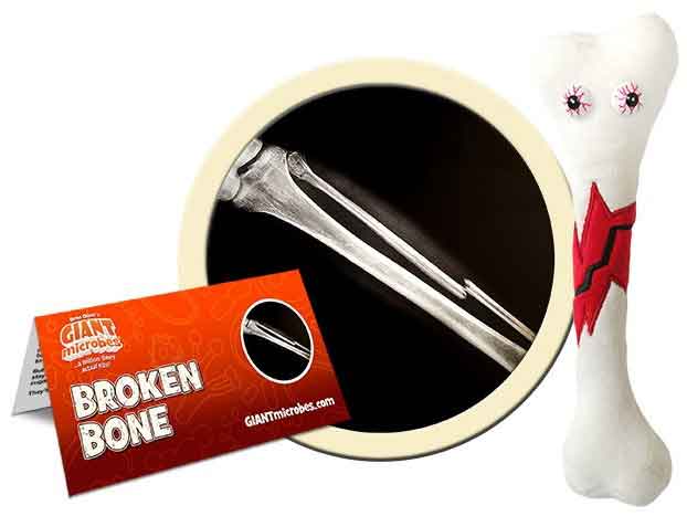 Giant Microbes Plush - Broken Bone close up