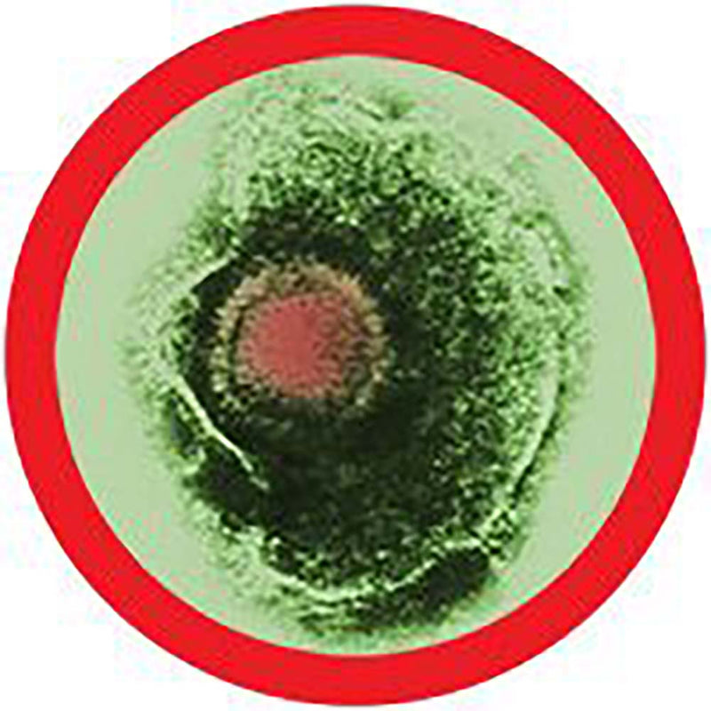Giant clearance microbes herpes